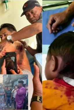 Korban Serangan Monyet Liar di Tembilahan Bertambah Menjadi 15, Satu Ekor Ditemukan Mati Tertembak
